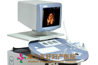 四维彩超能检查胎儿颜面部缺陷吗